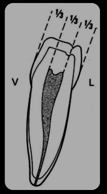 Les Prémolaires Inferieures– Odontologie Conservatrice Endodontie