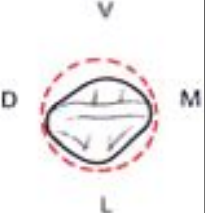 Anatomie descriptive des dents temporaires (Odontologie Conservatrice et Endodontie)