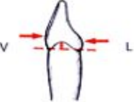 Anatomie descriptive des dents temporaires (Odontologie Conservatrice et Endodontie)