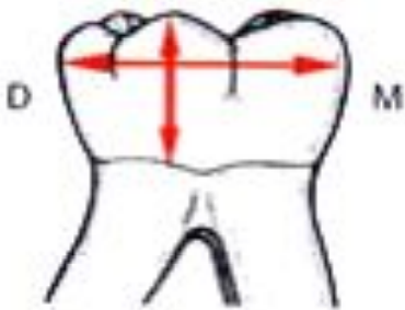Anatomie descriptive des dents temporaires (Odontologie Conservatrice et Endodontie)