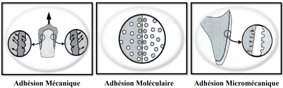 Les ciments de scellement & Les matériaux de collage – Prothèse Dentaire