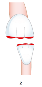 MORPHOLOGIE DENTAIRE DE L’ADULTE : INCISIVES / Anatomie dentaire