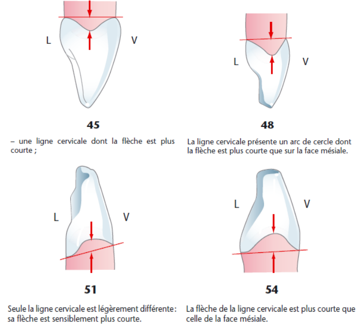 MORPHOLOGIE DENTAIRE DE L’ADULTE : INCISIVES / Anatomie dentaire