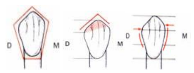 MORPHOLOGIE DENTAIRE DE L’ADULTE : LES CANINES / Anatomie dentaire