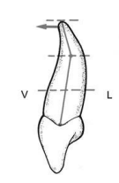 Caractères Morphologiques des Dents Temporaires / Anatomie dentaire