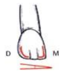 Caractères Morphologiques des Dents Temporaires / Anatomie dentaire