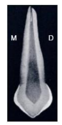 Caractères Morphologiques des Dents Temporaires / Anatomie dentaire
