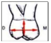 Caractères Morphologiques des Dents Temporaires / Anatomie dentaire