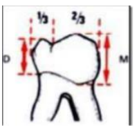 Caractères Morphologiques des Dents Temporaires / Anatomie dentaire