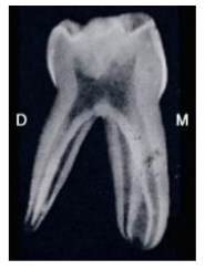 Caractères Morphologiques des Dents Temporaires / Anatomie dentaire
