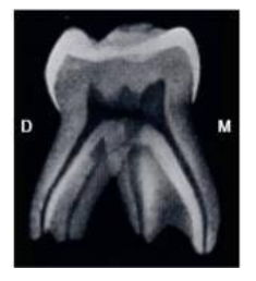 Caractères Morphologiques des Dents Temporaires / Anatomie dentaire