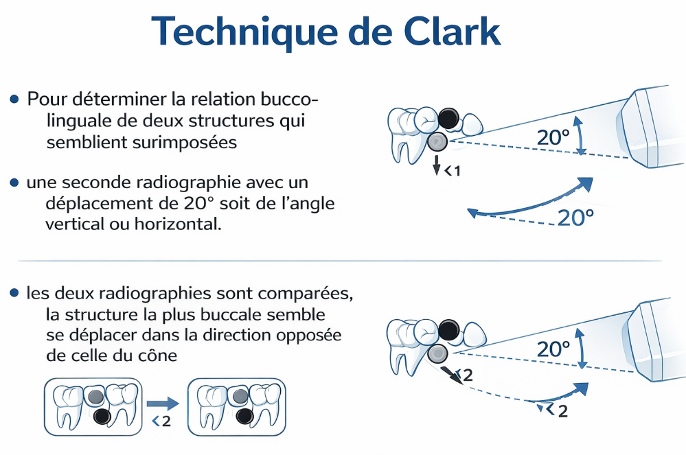 Guide Complet de la Radiographie Endo-Buccale en Odontologie
