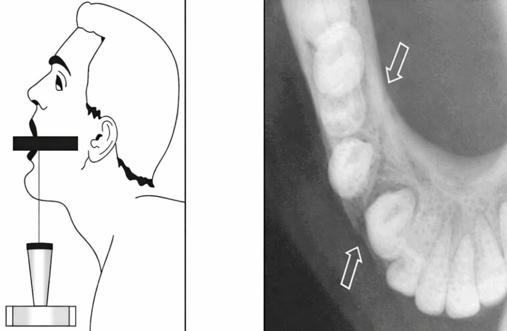 Guide Complet de la Radiographie Endo-Buccale en Odontologie
