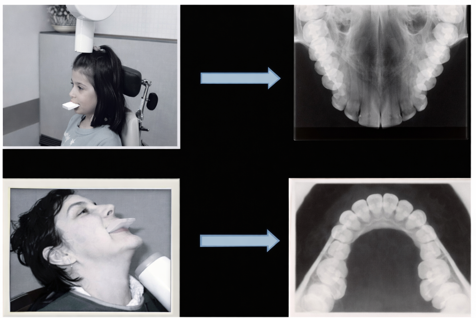 Guide Complet de la Radiographie Endo-Buccale en Odontologie
