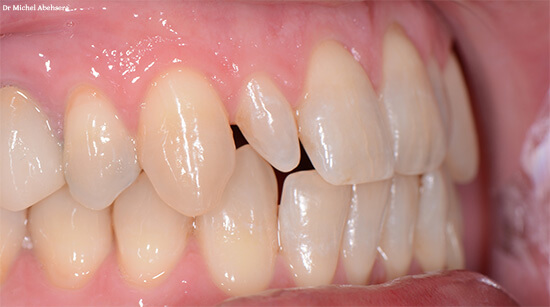 Anomalie dentaire forme