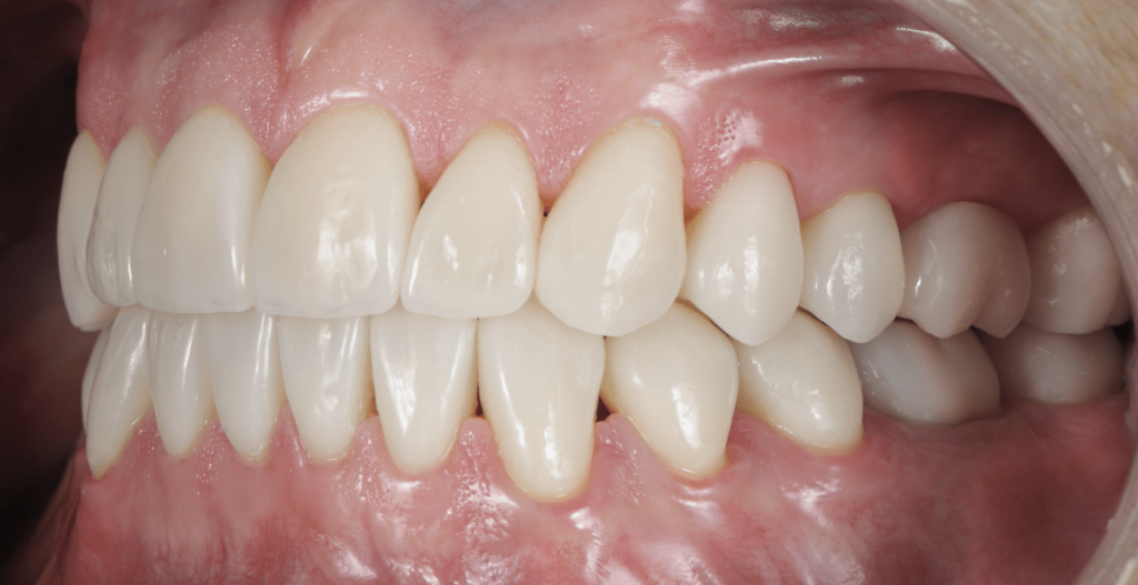 Occlusion, Clé de la Santé Bucco-Dentaire