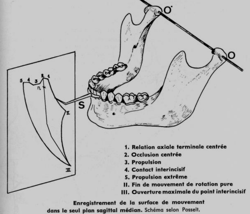 Examen du Chemin de Fermeture Physiologique