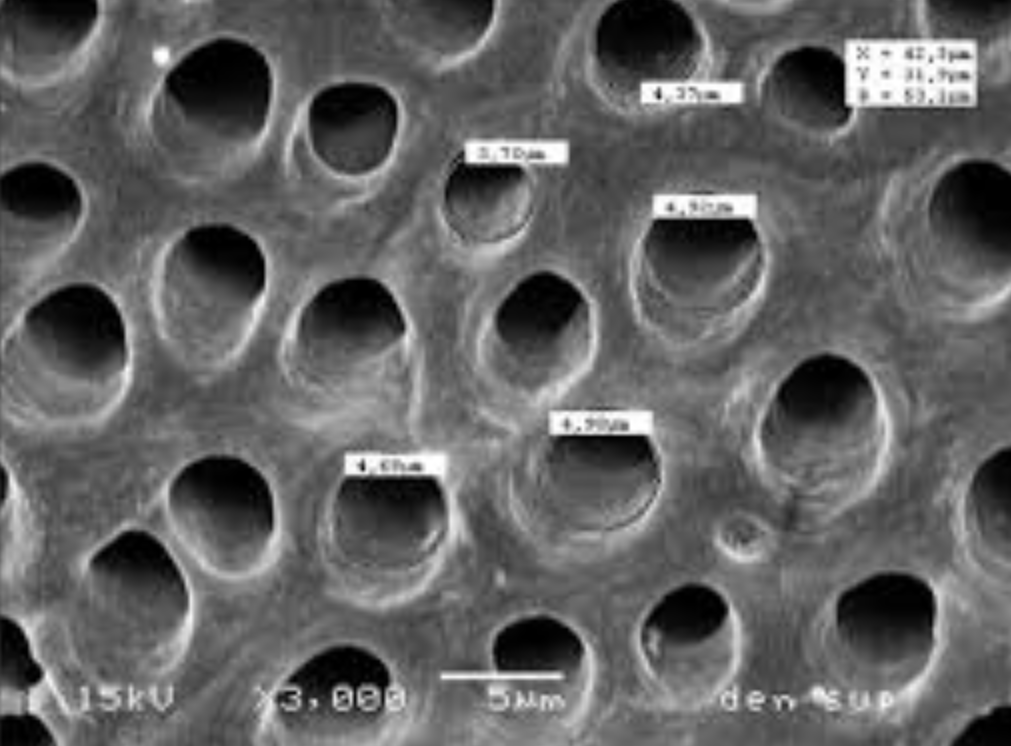 dentinal tubules scanning electron microscopy SEM