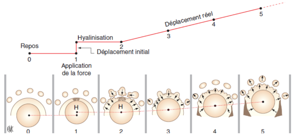 Correspondance entre la courbe de déplacement et les différents stades morphologiques de la réaction osseuse. H : hyalinisation.