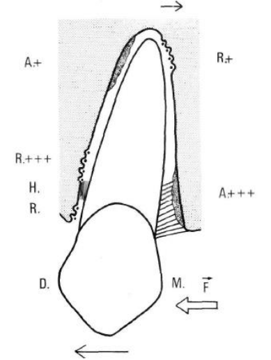 Mouvement de version
A = apposition;
R = résorption:
H = hyalinisalion.