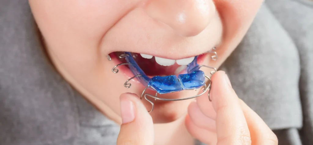 Traitement orthodontique enfant