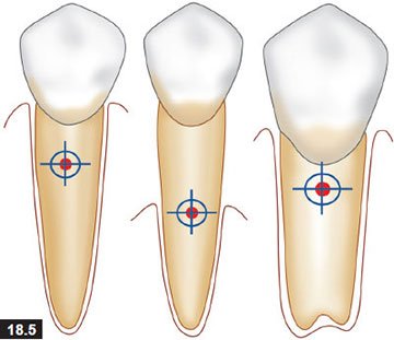 tooth root center of resistance orthodontic diagram anatomy