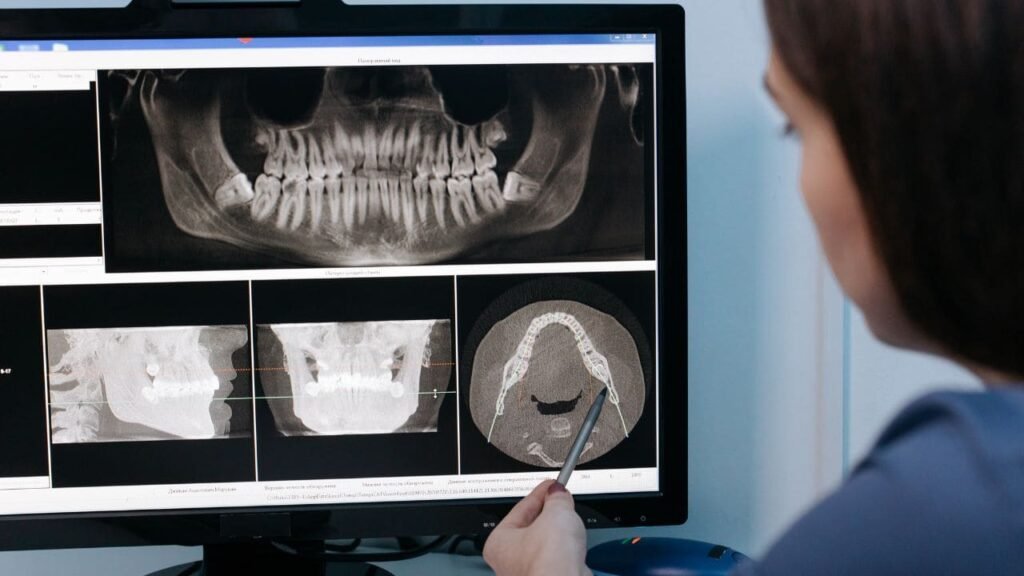 Les vitamines en odontostomatologie, Pathologie Bucco Dentaire