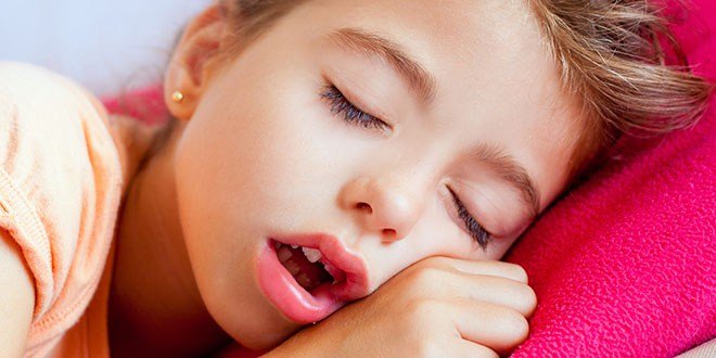 child mouth breathing, enfant respiration buccale, open mouth child sleeping
