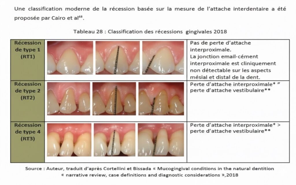 Évaluation du Parodonte Profond