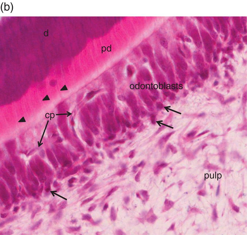 tertiary dentin formation odontoblasts histology