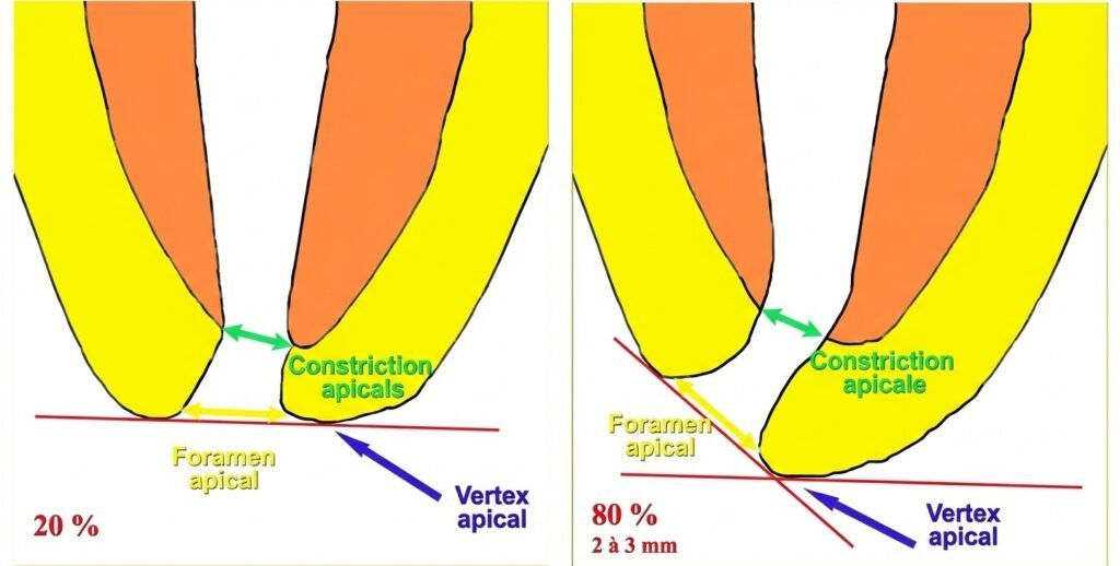 Radiographie dentaire