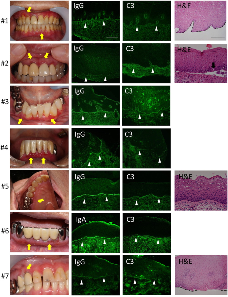 Image de fluorescence sur coupe tissulaire buccale