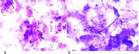 cytologie exfoliative buccale au microscope