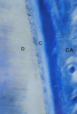Figure 3 : Aspect microscopique du ligament parodontal. (D) : dentine, (C) : cément, (CA) : os cortical.
