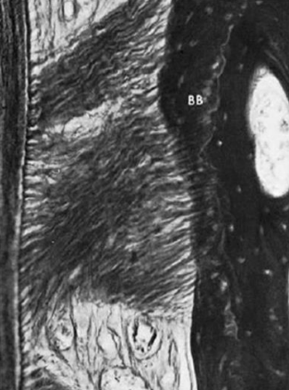 Figure 5 : Fibres de collagène incrustées dans le cément (à gauche) et dans l'os (à droite) (tache d'argent). Notez les fibres de Sharpey dans l'os (B8) recouvrant l'os lamellaire.