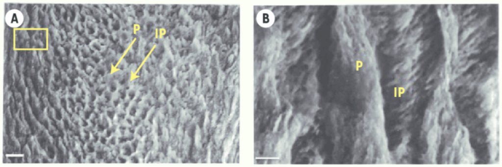 Coupe d'émail observée au microscope électronique à balayage