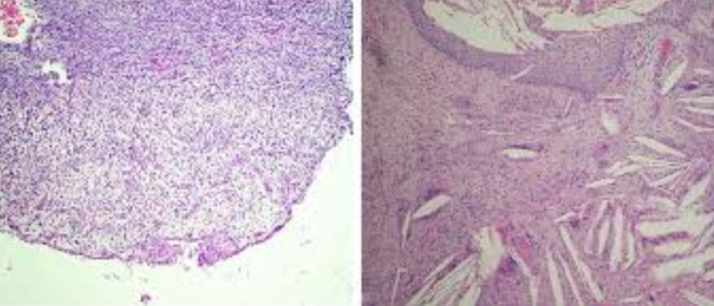 Coupe histologique avec les 4 zones concentriques