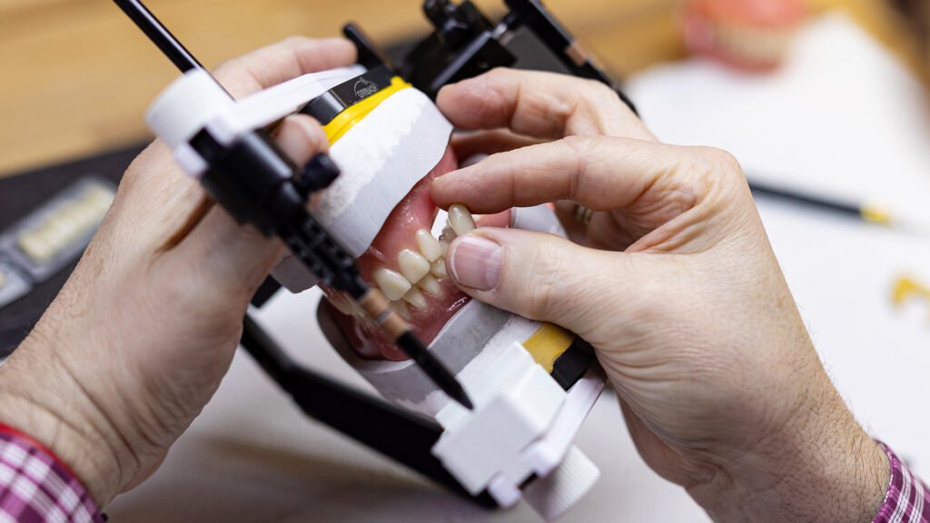 L'articulateur outil central de l'analyse et de la fabrication prothétique