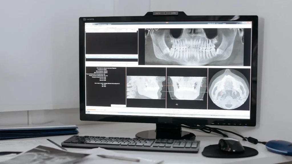 Radiographie 3D Cone Beam : Investissement et Amortissement 2025