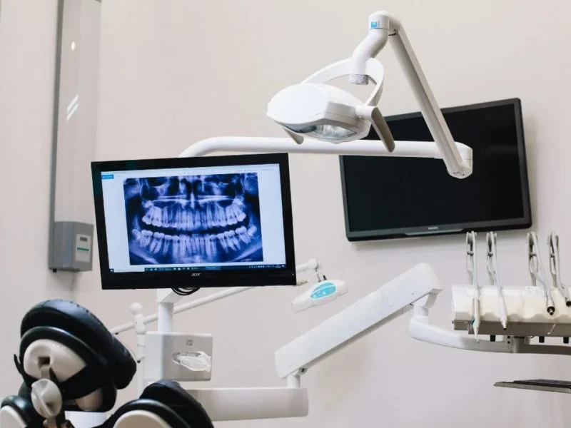 Empreinte Optique Dentaire : La Révolution Numérique pour Votre Sourire