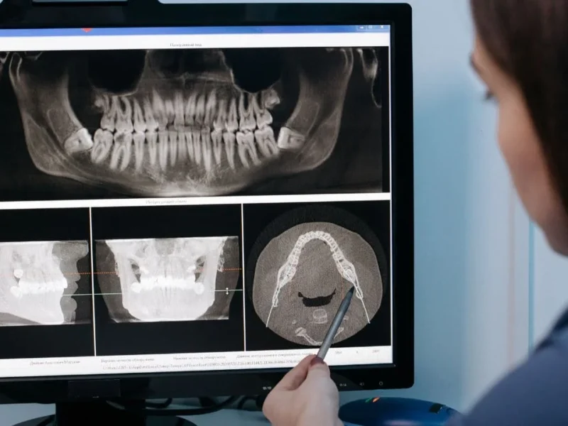 Base Données Patients RGPD : Solutions Sécurisées pour Votre Cabinet Dentaire