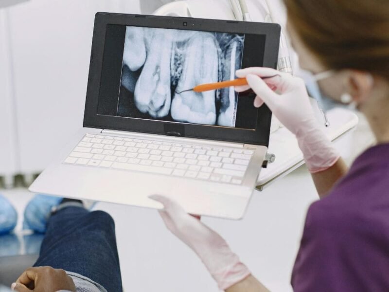 Brossettes Interdentaires : Mode d'Emploi Complet pour une Hygiène Parfaite