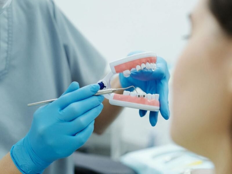 Taches Brunes sur les Dents : Causes, Solutions et Conseils pour Retrouver un Sourire Éclatant